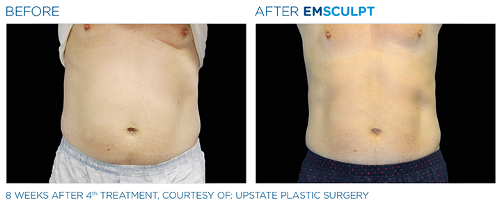 Harvard Trained Doctors  How to find the best doctor for Emsculpt