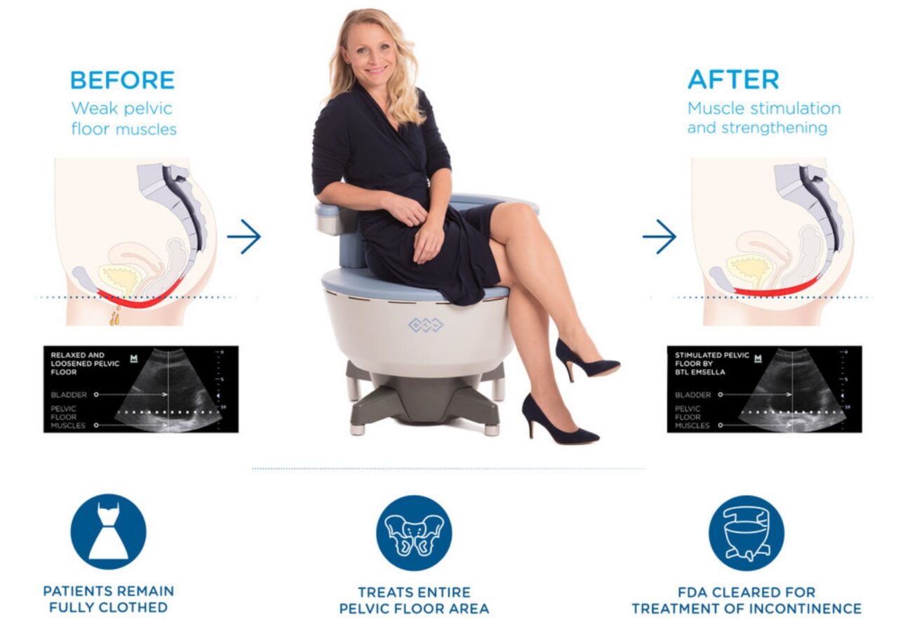 Incontinence Solution | Emsella Chair
